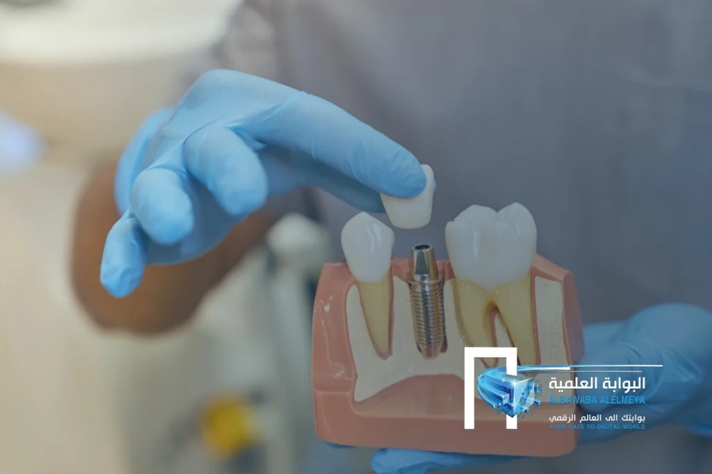 The Future of Dental Implants: Trends and Innovations