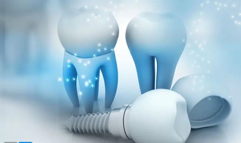 future of dental implants